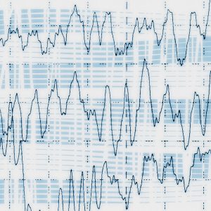 Brainwaves recorded during an electrencephalogram test for epilepsy.