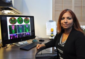 MS epilepsy